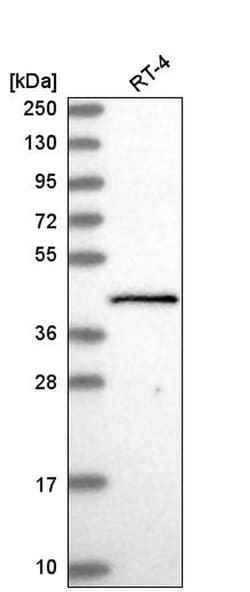 Invitrogen GTF2H2 Polyclonal Antibody 100 &mu;L; Unconjugated:Antibodies,