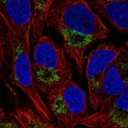 Invitrogen NAT14 Polyclonal Antibody 100 &mu;L; Unconjugated:Antibodies,