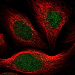 Invitrogen ARHGAP23 Polyclonal Antibody 100 &mu;L; Unconjugated:Antibodies,