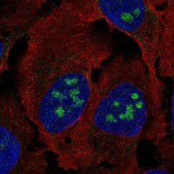 Invitrogen BLCAP Polyclonal Antibody 100 &mu;L; Unconjugated:Antibodies,