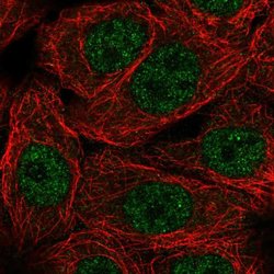 Invitrogen NXT1 Polyclonal Antibody 100 &mu;L; Unconjugated:Antibodies,