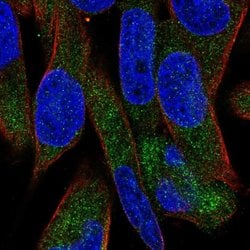 Invitrogen UGT3A1 Polyclonal Antibody 100 &mu;L; Unconjugated:Antibodies,