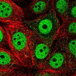 Invitrogen TOB1 Polyclonal Antibody 100 &mu;L; Unconjugated:Antibodies,