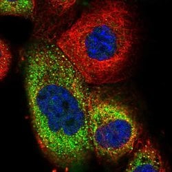 TRIM73 Polyclonal Antibody:Antibodies, Polyclonal