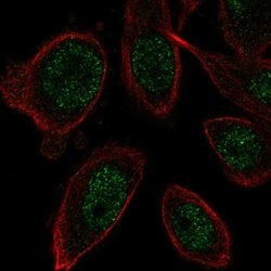Invitrogen ZNF664 Polyclonal Antibody 100 &mu;L; Unconjugated:Antibodies,