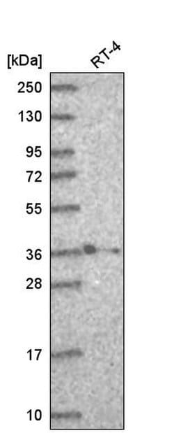 Invitrogen HOXB2 Polyclonal Antibody 100 &mu;L | Buy Online | Invitrogen&trade; | Fisher Scientific