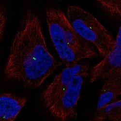 Invitrogen KIAA0101 Polyclonal Antibody 100 &mu;L; Unconjugated:Antibodies,