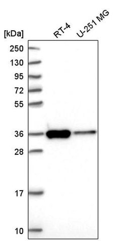 SFXN3 Polyclonal Antibody:Antibodies, Polyclonal