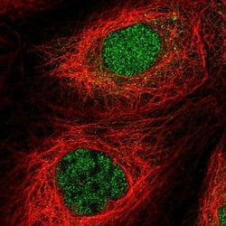 Invitrogen MTMR15 Polyclonal Antibody 100 &mu;L; Unconjugated:Antibodies,