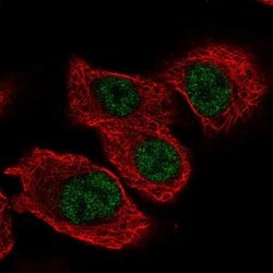 TSEN34 Polyclonal Antibody:Antibodies, Polyclonal