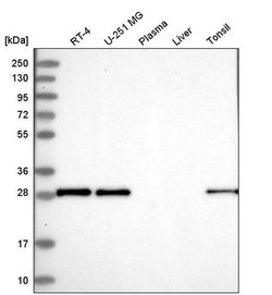 Invitrogen MOSPD3 Polyclonal Antibody 100 &mu;L | Buy Online | Invitrogen&trade; | Fisher Scientific