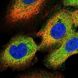 OSBPL3 Polyclonal Antibody:Antibodies, Polyclonal