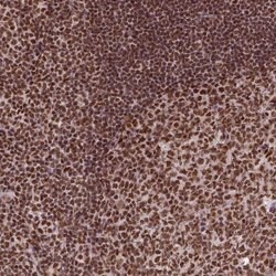 Invitrogen CCAR1 Polyclonal Antibody 100 &mu;L; Unconjugated:Antibodies,