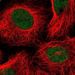 Invitrogen TAF11 Polyclonal Antibody 100 &mu;L; Unconjugated:Antibodies,