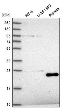 Invitrogen TAF11 Polyclonal Antibody 100 &mu;L; Unconjugated:Antibodies,