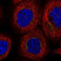 Invitrogen DYM Polyclonal Antibody 100 &mu;L | Buy Online | Invitrogen&trade; | Fisher Scientific