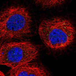 RDH10 Polyclonal Antibody:Antibodies, Polyclonal