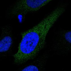 Invitrogen CYP2S1 Polyclonal Antibody 100 &mu;L; Unconjugated:Antibodies,