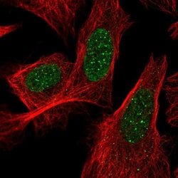 ACD Polyclonal Antibody:Antibodies, Polyclonal