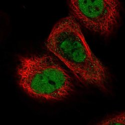 Invitrogen Treslin Polyclonal Antibody 100 &mu;L; Unconjugated:Antibodies,