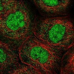 Invitrogen ANKRD11 Polyclonal Antibody 100 &mu;L; Unconjugated:Antibodies,