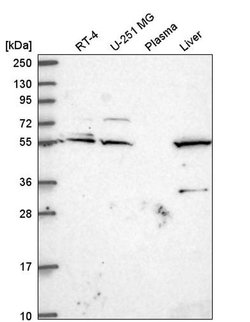 Invitrogen IRF2BP1 Polyclonal Antibody 100 &mu;L | Buy Online | Invitrogen&trade; | Fisher Scientific