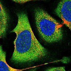 eIF2b alpha Polyclonal Antibody:Antibodies, Polyclonal