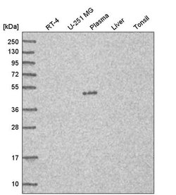 Invitrogen C7orf25 Polyclonal Antibody 100 &mu;L; Unconjugated:Antibodies,