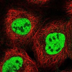 Invitrogen RBM15 Polyclonal Antibody 100 &mu;L; Unconjugated:Antibodies,
