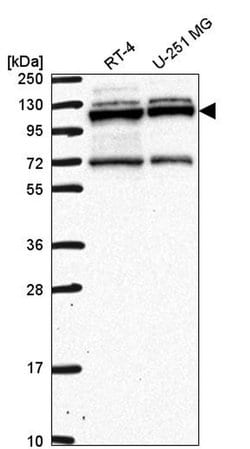 Invitrogen RBM15 Polyclonal Antibody 100 &mu;L; Unconjugated:Antibodies,