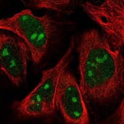 Invitrogen ZNF507 Polyclonal Antibody 100 &mu;L; Unconjugated:Antibodies,