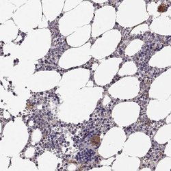 Invitrogen KRT81 Polyclonal Antibody 100 &mu;L; Unconjugated:Antibodies,