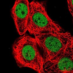 BCL7B Polyclonal Antibody:Antibodies, Polyclonal