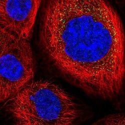 PNAS4 Polyclonal Antibody:Antibodies, Polyclonal