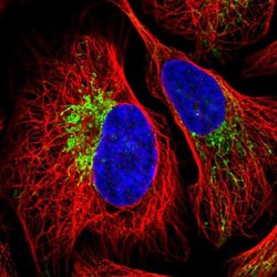 Invitrogen ZNF211 Polyclonal Antibody 100 &mu;L | Buy Online | Invitrogen&trade; | Fisher Scientific