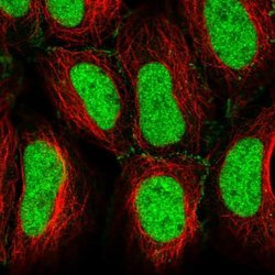 Invitrogen CREB5 Polyclonal Antibody 100 &mu;L; Unconjugated:Antibodies,