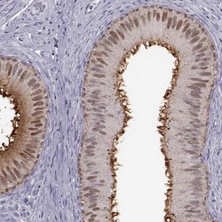 Invitrogen GPR64 Polyclonal Antibody 100 &mu;L; Unconjugated:Antibodies,