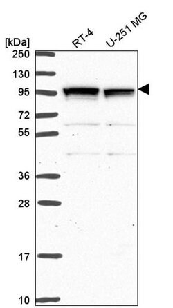 Invitrogen GPR64 Polyclonal Antibody 100 &mu;L; Unconjugated:Antibodies,