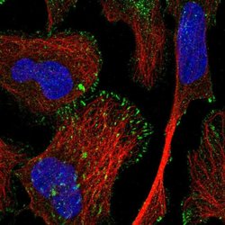 Invitrogen TRIM62 Polyclonal Antibody 100 &mu;L; Unconjugated:Antibodies,