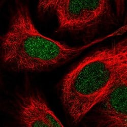 Invitrogen PITX2 Polyclonal Antibody 100 &mu;L; Unconjugated:Antibodies,