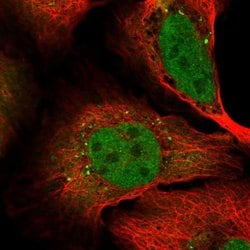 Invitrogen SHISA2 Polyclonal Antibody 100 &mu;L; Unconjugated:Antibodies,