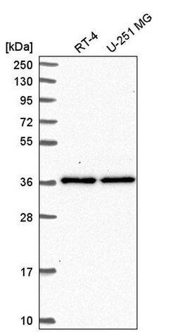 Invitrogen SHISA2 Polyclonal Antibody 100 &mu;L; Unconjugated:Antibodies,