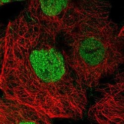 Invitrogen SPEN Polyclonal Antibody 100 &mu;L; Unconjugated:Antibodies,