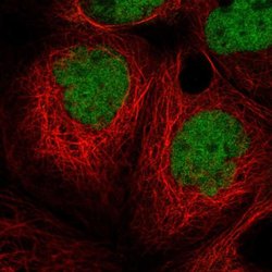Invitrogen MIER1 Polyclonal Antibody 100 &mu;L; Unconjugated:Antibodies,