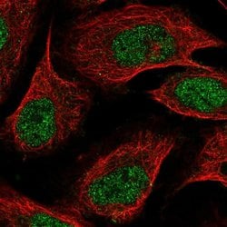 Invitrogen ZDBF2 Polyclonal Antibody 100 &mu;L; Unconjugated:Antibodies,