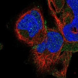 Invitrogen ADAM22 Polyclonal Antibody 100 &mu;L; Unconjugated:Antibodies,