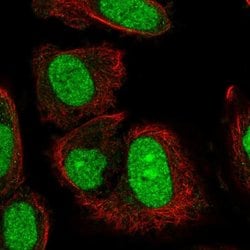 Invitrogen TRMT6 Polyclonal Antibody 100 &mu;L; Unconjugated:Antibodies,