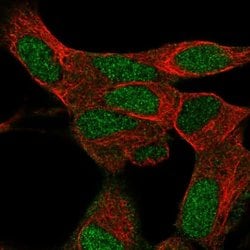 Invitrogen KRBA1 Polyclonal Antibody 100 &mu;L; Unconjugated:Antibodies,