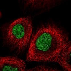 METTL1 Polyclonal Antibody:Antibodies, Polyclonal