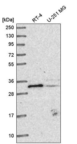 METTL1 Polyclonal Antibody:Antibodies, Polyclonal